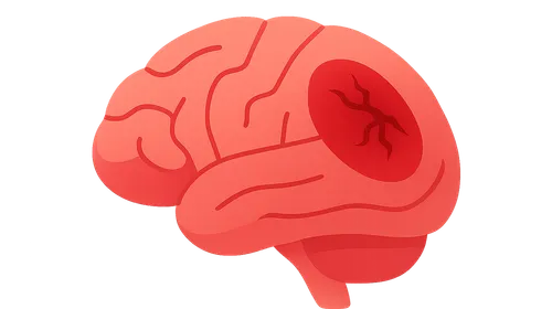 Trauma to the Central Nervous System
