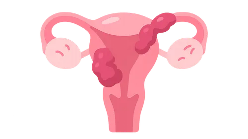 Pelvic Inflammatory Disease