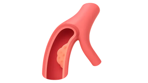 Peripheral arterial disease