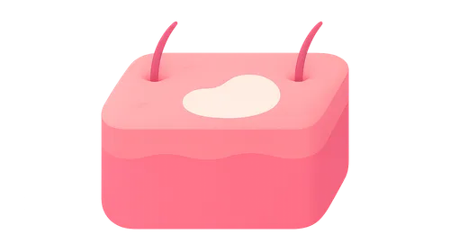 Management of Hypopigmentation