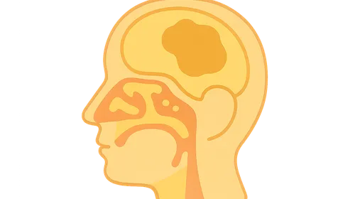 Complications of Sinusitis