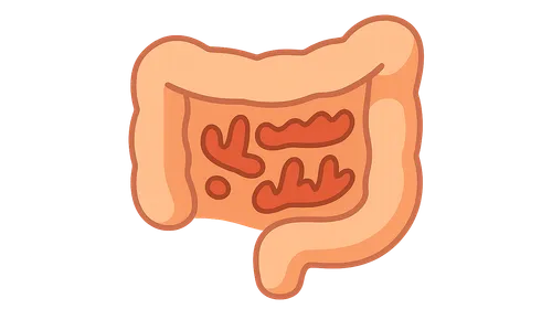 Malabsorption syndromes
