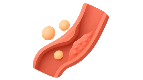 Dyslipidemias and Atherosclerosis