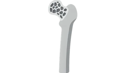 Metabolic Bone Diseases