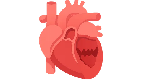 Valvular heart disease
