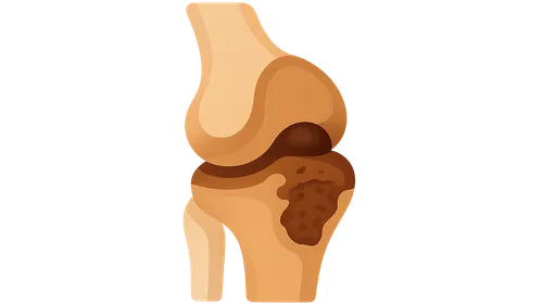Bone and joint pathology