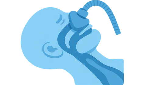 Perioperative Management of Sleep Apnea