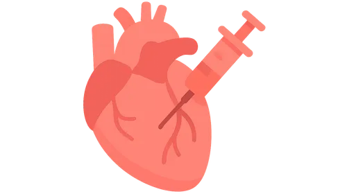 Vasodilators in Cardiac Anesthesia