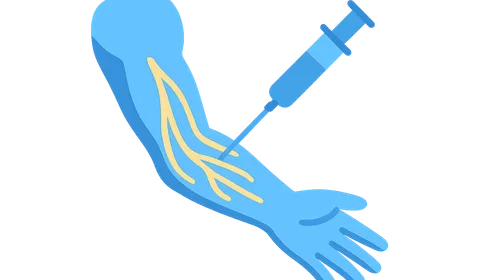 Peripheral Nerve Blocks: Upper Extremity