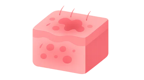 Cutaneous Manifestations of Systemic Diseases