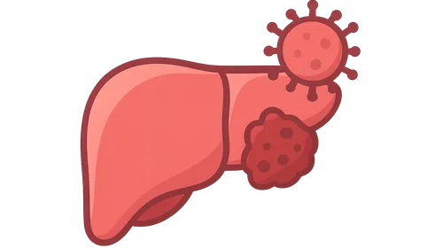 Hepatitis C and hepatocellular carcinoma