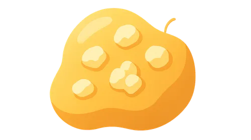 Pathologic calcification