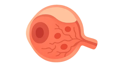 Inflammatory Retinal Diseases