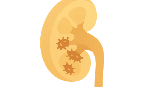 Urinary Tract Infections