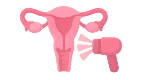 Radiation Therapy in Gynecologic Malignancies