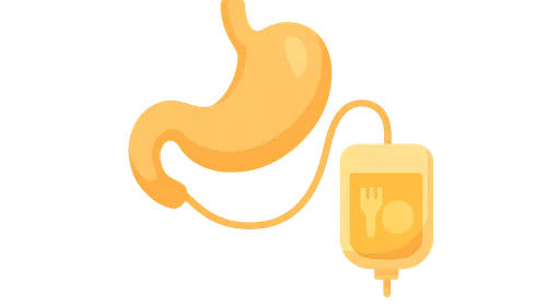 Nutrition support in surgical patients