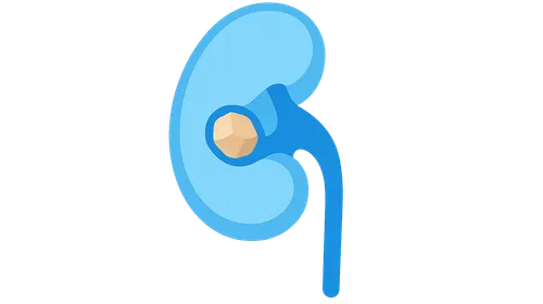 Kidney stone management