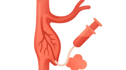 Angiography Techniques