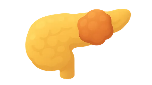 Pancreatic Neoplasms