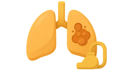 Ventilator-Associated Pneumonia