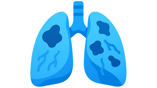 Obstructive Pulmonary Diseases