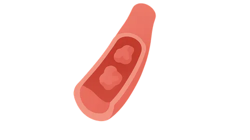 Hemophilia and Von Willebrand Disease
