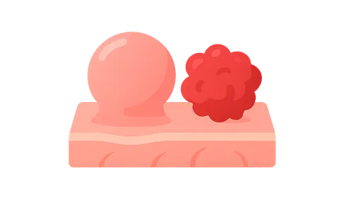 Characteristics of Benign and Malignant Neoplasms