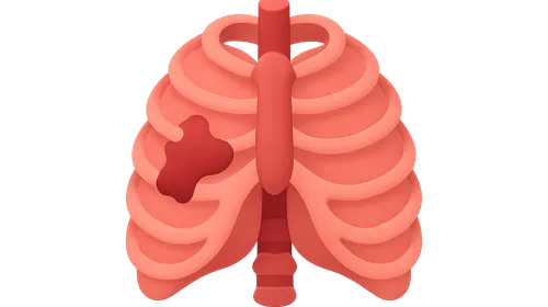 Chest Trauma Imaging