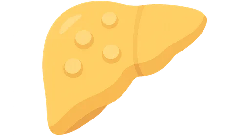 GSD type VII (Tarui disease)