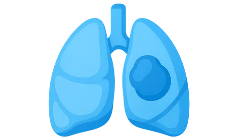 Mediastinal masses evaluation and management