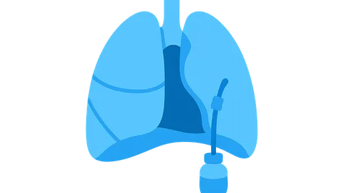Pneumothorax management