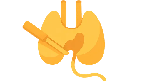 Recurrent laryngeal nerve protection