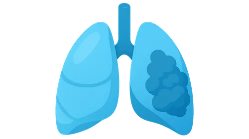 Chronic Respiratory Diseases