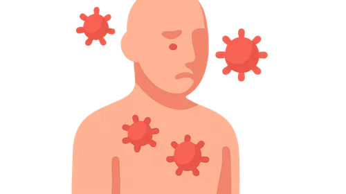 Infection in Immunocompromised Hosts