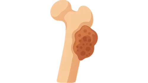 Bone and Soft Tissue Pathology