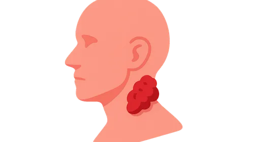 Management of Head and Neck Cancer