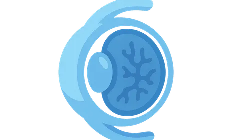 Posterior Capsular Opacification