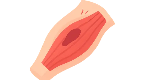 Muscle Strains and Contusions