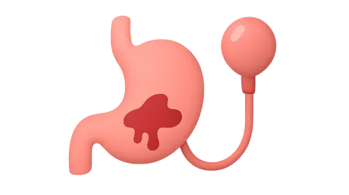 GI bleeding management