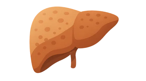 Cirrhosis management