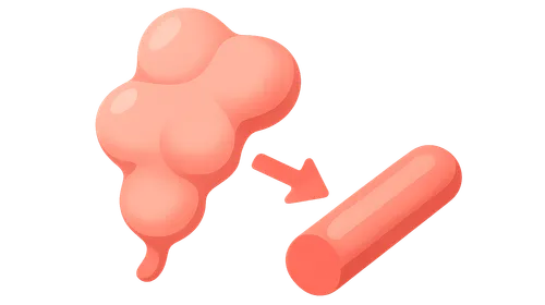 Angiotensinogen to angiotensin I conversion