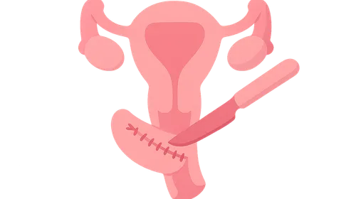 Pelvic organ prolapse repair