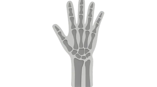 Radiographic Anatomy of Extremities