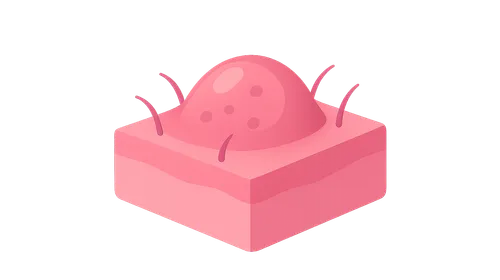 Biological Agents in Dermatology