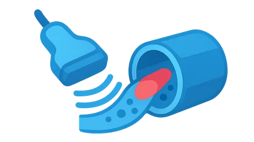 Doppler Ultrasound Principles and Applications