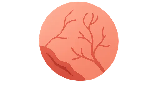 Retinopathy of Prematurity