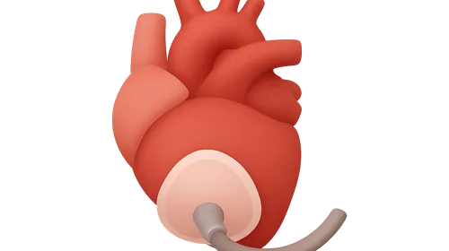 Perioperative Cardiac Complications