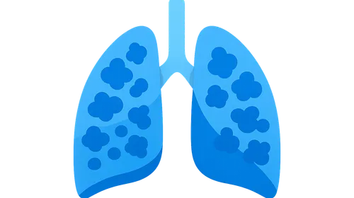 Hypersensitivity pneumonitis