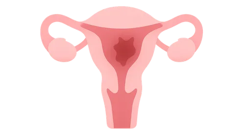 Pelvic Pain Syndromes