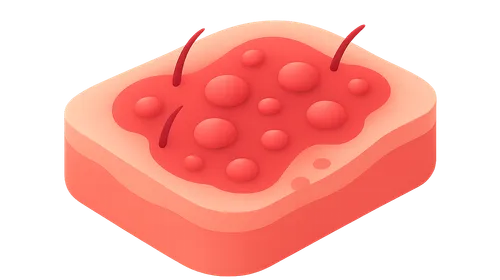 Inflammatory dermatoses